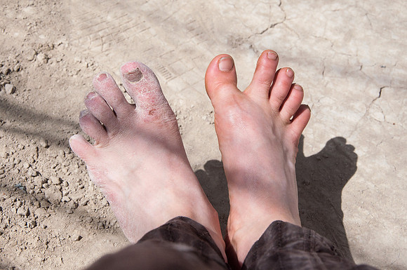 Take care of your feet!